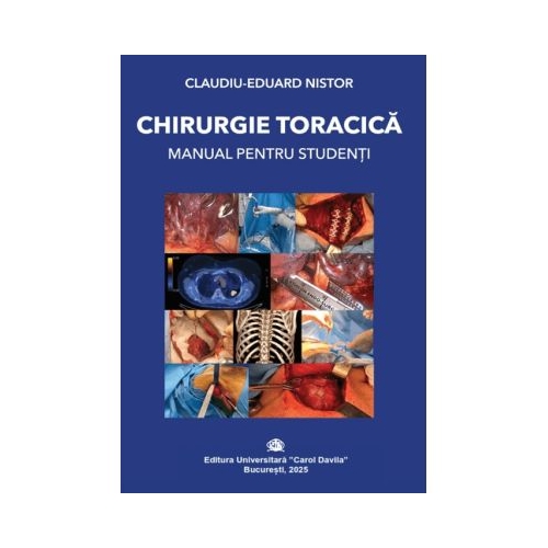 Chirurgie toracica. Manual pentru studenti - Claudiu-Eduard Nistor