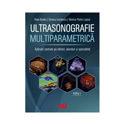 Ultrasonografie multiparametrica. Aplicatii centrate pe tehnici, aborduri si specialitati - Radu Badea
