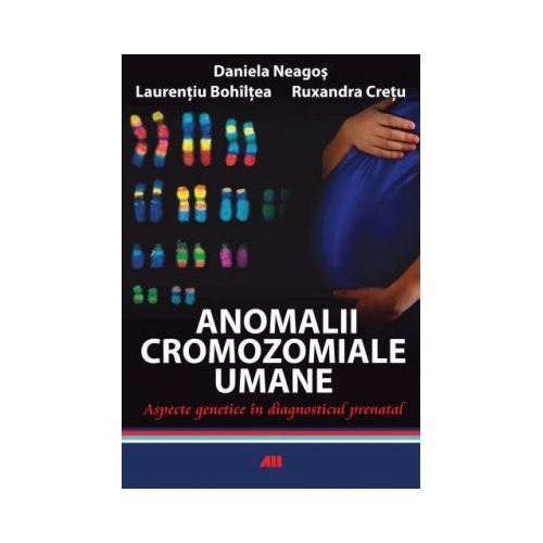 Anomalii cromozomiale umane - Daniela Neagos, Ruxandra Cretu
