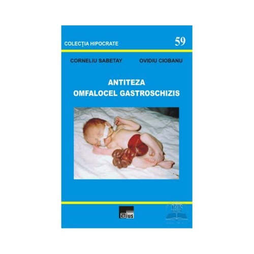 Antiteza omfalocel gastroschizis - Corneliu Sabetay, Ovidiu Ciobanu