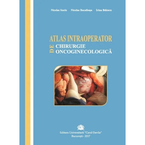 Atlas intraoperator de chirurgie oncoginecologica - Nicolae Suciu, Nicolae Bacalbasa, Irina Balescu