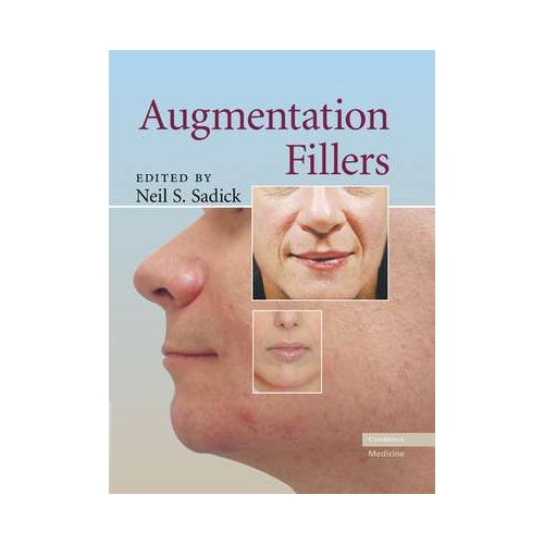 Augmentation Fillers - Neil S. Sadick MD