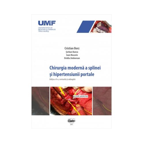 Chirurgia moderna a splinei si hipertensiunii portale - Cristian Borz, Serban Bancu, Ioan Macarie