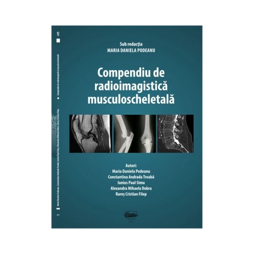 Compendiu de radioimagistica musculoscheletala - Maria Daniela Podeanu Carti diverse University Press grupdzc