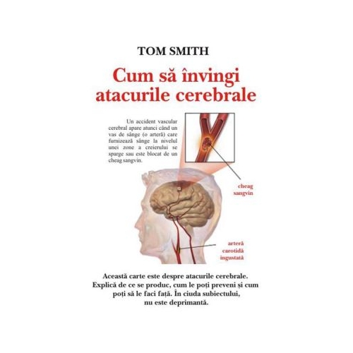 Cum sa invingi atacurile cerebrale – Tom Smith