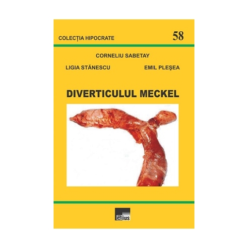 Diverticulul Meckel - Corneliu Sabetay, Ligia Stanescu, Emil Plesea