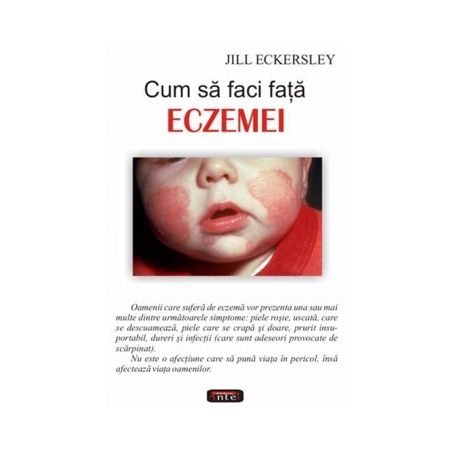 Cum sa faci fata eczemei - Jill Eckersley