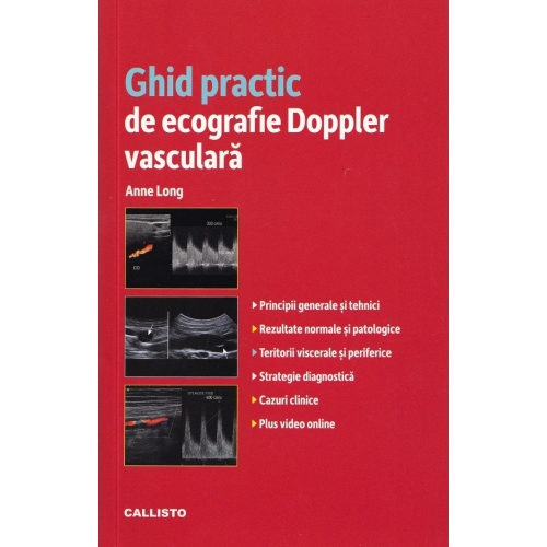 Ghid practic de ecografie Doppler vasculara - Anne Long