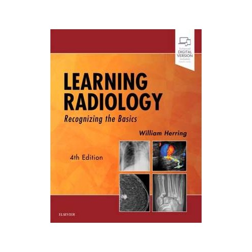 Learning Radiology: Recognizing the Basics - William Herring