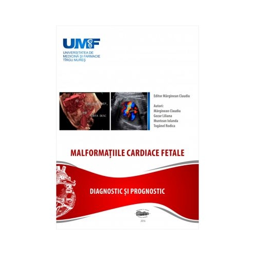 Malformatii cardiace fetale - Claudiu Marginean