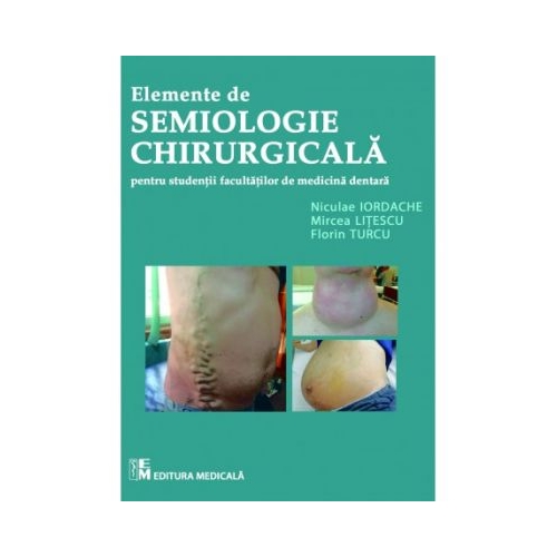 Elemente de semiologie chirurgicala pentru studentii facultatilor de medicina dentara - Mircea Litescu