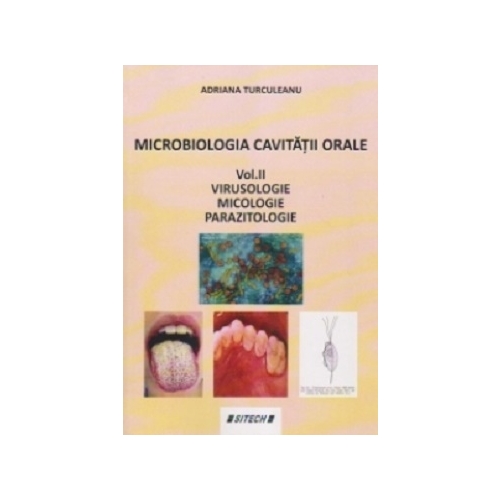 Microbiologia cavitatii orale. Volumul 2. Virusologie. Micologie. Parazitologie - Adriana Turculeanu