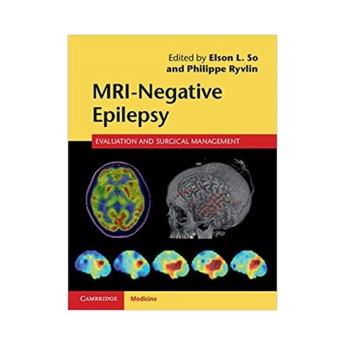MRI-Negative Epilepsy: Evaluation and Surgical Management - Elson L. So, Philippe Ryvlin