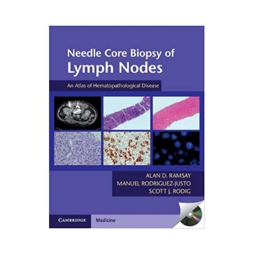 Needle Core Biopsy of Lymph Nodes with DVD-ROM: An Atlas of Hematopathological Disease - Alan D. Ramsay, Manuel Rodriguez-Justo, Scott J. Rodig