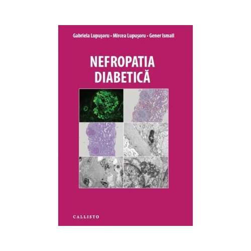 Nefropatia Diabetica - Gabriela Lupusoru, Mircea Lupusoru, Gener Ismail