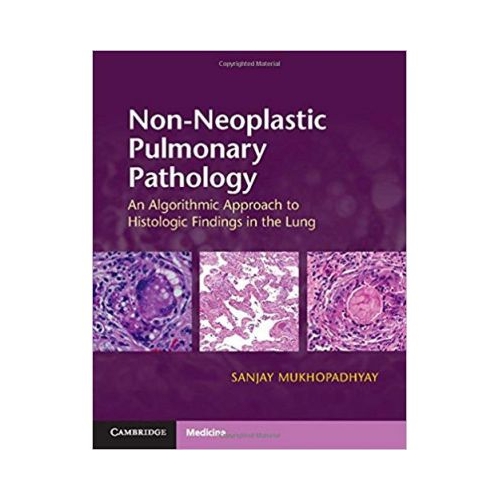 Non-Neoplastic Pulmonary Pathology with Online Resource: An Algorithmic Approach to Histologic Findings in the Lung - Sanjay Mukhopadhyay