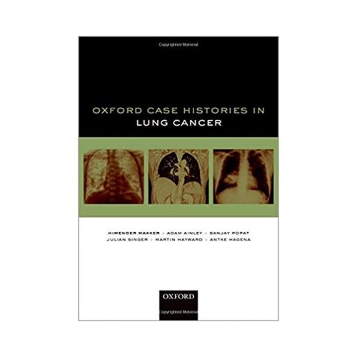 Oxford Case Histories in Lung Cancer - Himender K. Makker, Adam Ainley, Sanjay Popat, Julian Singer, Martin Hayward, Antke Hagena