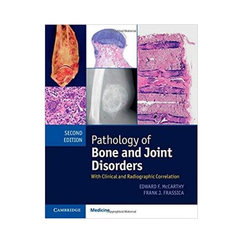 Pathology of Bone and Joint Disorders Print and Online Bundle: With Clinical and Radiographic Correlation - Edward F. McCarthy, Frank J. Frassica