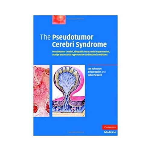 The Pseudotumor Cerebri Syndrome: Pseudotumor Cerebri, Idiopathic Intracranial Hypertension, Benign Intracranial Hypertension and Related Conditions - Ian Johnston, Brian Owler, John Pickard