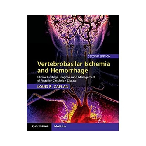 Vertebrobasilar Ischemia and Hemorrhage: Clinical Findings, Diagnosis and Management of Posterior Circulation Disease - Louis R. Caplan