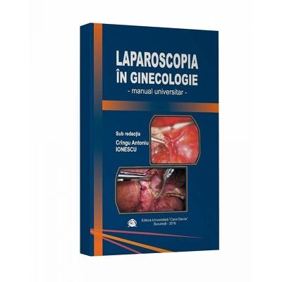 Laparoscopia in ginecologie. Manual universitar