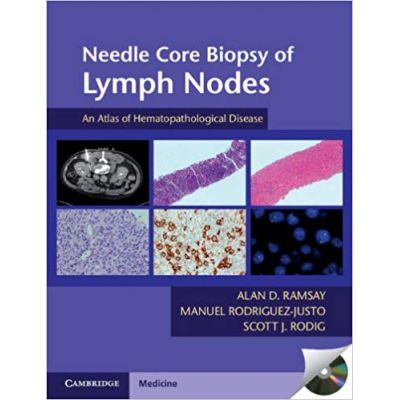 Needle Core Biopsy of Lymph Nodes with DVD-ROM: An Atlas of Hematopathological Disease - Alan D. Ramsay, Manuel Rodriguez-Justo, Scott J. Rodig