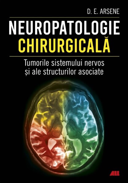 Neuropatologie chirurgicala. Tumorile sistemului nervos si ale structurilor asociate - Dr. Dorel Eugen Arsene