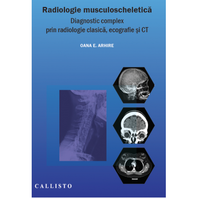 Radiologie musculo-scheletica, diagnostic complex prin radiologie clasica, ecografie si CT - Elena Oana Arhire
