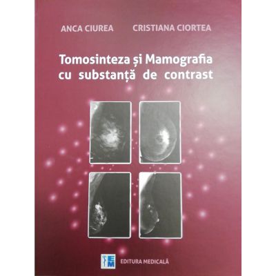 Tomosinteza si Mamografia cu substanta de contrast - Anca Ciurea, Cristiana Ciortea