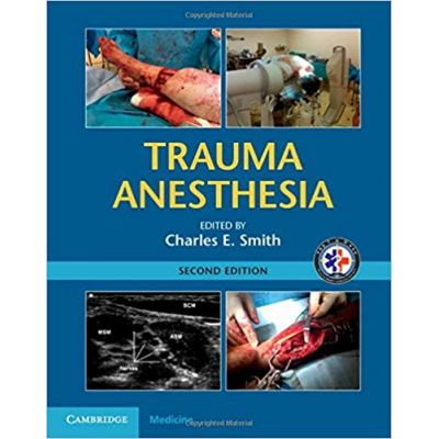 Trauma Anesthesia - Charles E. Smith